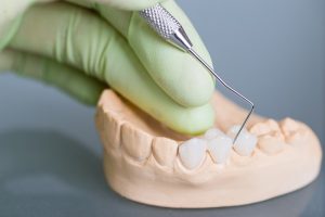 Periodontitis vs. Gingivitis